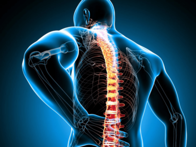 spinal-stenoz-1024x978